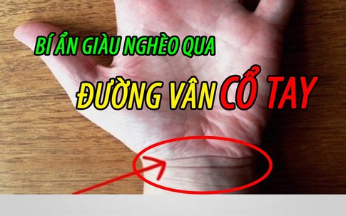 Nếu có đường vân cổ tay thứ 4, bạn sẽ có được điều tuyệt vời!