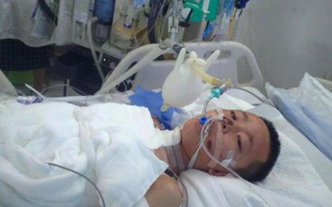 Cậu bé 7 tuổi bỏng nặng vì quyết không rời mẹ khi nhà cháy