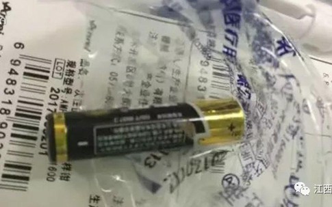 Bé gái 8 tuổi nuốt cục pin vào bụng, hành động của bà nội suýt làm cháu mất mạng