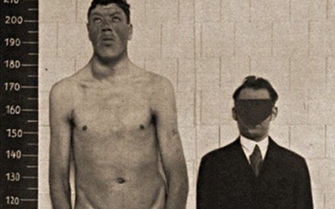 Câu chuyện kỳ lạ của người đàn ông sinh ra là người lùn nhưng đến khi chết đi lại trong hình hài người khổng lồ