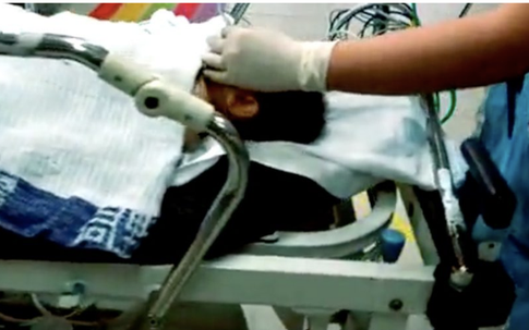 Bé trai 8 tháng tuổi nguy kịch vì "góc chết" ở chung cư không phải ai cũng để ý