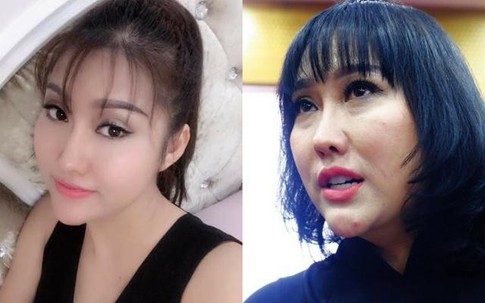 Phi Thanh Vân: Hành trình dao kéo từ da nâu đến Hoa hậu và hình ảnh hiện tại gây sốc