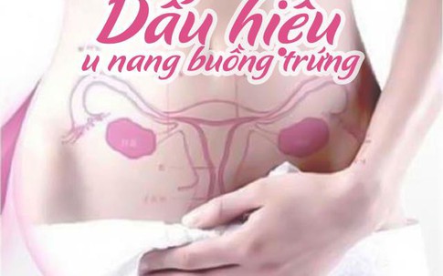 6 dấu hiệu u nang buồng trứng không phải ai cũng biết