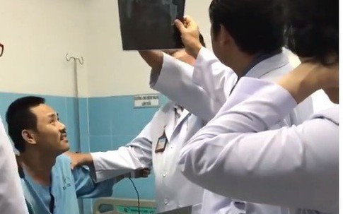 Dùng xi măng kháng sinh chữa lành khớp háng nhiễm trùng sau 14 lần mổ