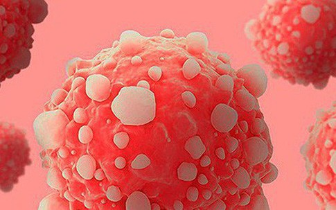 Các dấu hiệu của ung thư tuyến tụy không bao giờ được bỏ qua