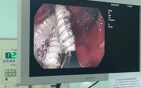 Để con nhỏ 3 tuổi trông em mới 37 ngày tuổi, trong phút chốc đã thấy con sùi bọt mép vì thứ kinh khủng này