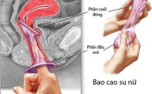 Những sự thật ít biết về bao cao su nữ