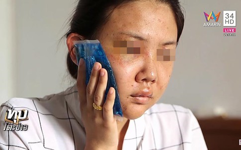 Cô gái bị người yêu 7 năm dùng mũ bảo hiểm đánh bầm dập lên tiếng, kẻ bạo hành đã bị bắt để thẩm vấn