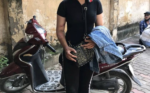 Thiếu nữ vi phạm giao thông tông gãy chân cảnh sát cơ động