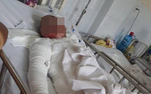 Bi kịch của người phụ nữ “hai lần đò” bị chồng thiêu sống
