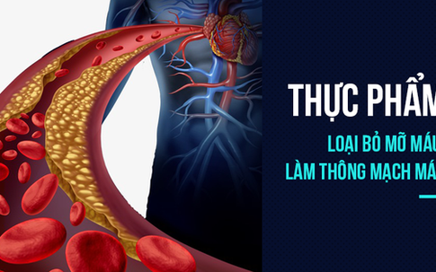 5 thực phẩm "phá hủy" mỡ máu: Mỗi ngày ăn 1 món để mạch máu thông suốt, trẻ hóa kỳ diệu