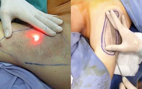 Nhật ký ‘đau thương’ của cô gái trẻ bỏ số tiền lớn triệt hôi nách