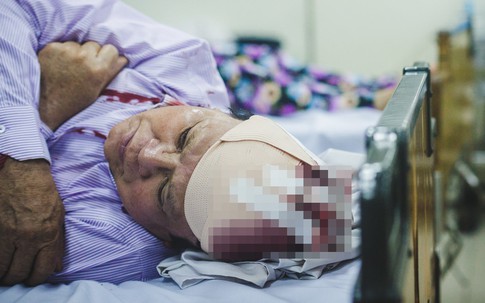 Mổ lấy được cục máu đông gây đột quỵ dài gần 10cm