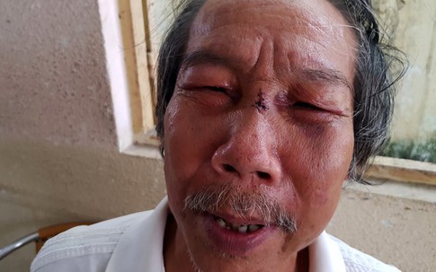 Bảo vệ đánh nhà thơ 68 tuổi ngất xỉu