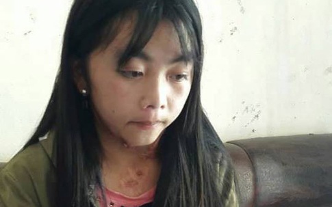 Cô bé dân tộc Mông từng mắc bệnh lạ kêu cứu vì phải bỏ học lấy chồng