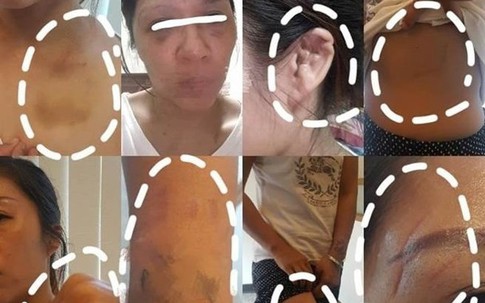 Chồng ngoại tình đánh vợ biến dạng, đến khi biết hắn bạo hành luôn trẻ con đã khiến cư dân mạng phẫn nộ thốt lên: "Đồ cặn bã"