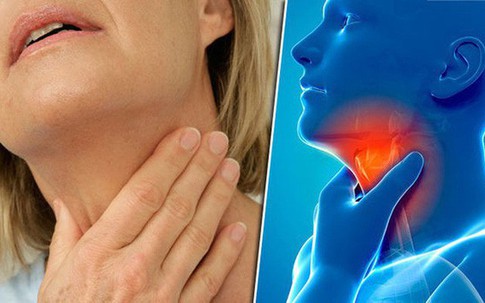BS cảnh báo 5 thói quen bạn nên thay đổi ngay vì có thể "nuôi lớn" tế bào ung thư vòm họng