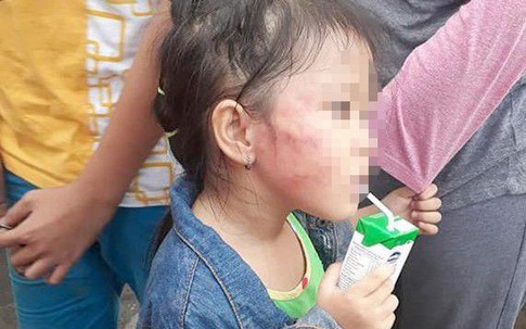 Những vụ bạo hành trẻ mầm non xôn xao dư luận năm 2018