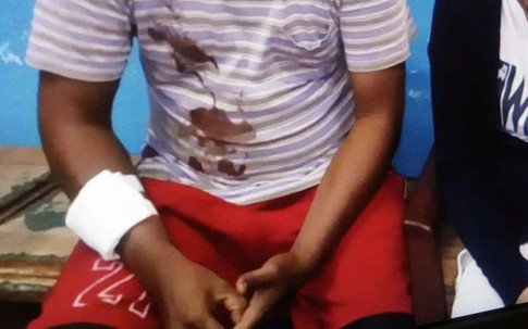 Rượu chè liên miên với bạn nhậu, vợ cầm dao đâm chồng trọng thương, nhưng cái kết mới là điều khiến ai cũng bất ngờ