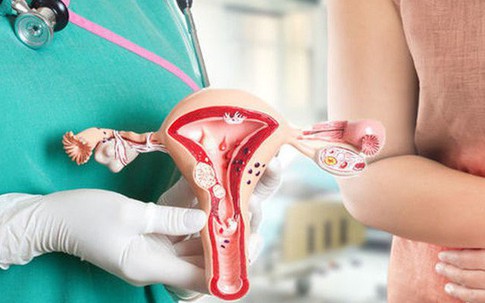 Tầm quan trọng xã hội hóa trong việc cung cấp sản phẩm, dịch vụ dự phòng bệnh ung thư