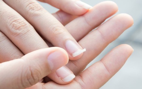 10 biểu hiện bất thường trên tay đang ngầm “tố cáo” hàng loạt vấn đề sức khỏe mà bạn không ngờ đến