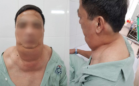 Uống rượu 40 năm, người đàn ông Hà Nội thành ‘dị nhân’
