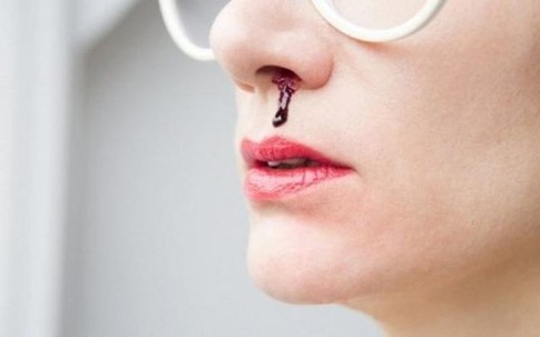 3 triệu chứng khó chịu khi ngủ cảnh báo bệnh nhồi máu não