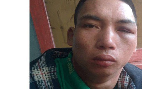 Bắc Giang: Chồng sát hại vợ dã man tại hiên nhà