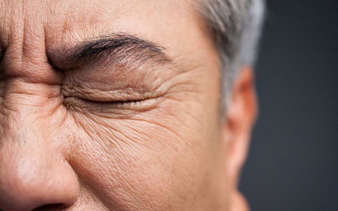 Người đàn ông 50 tuổi bị đột quỵ, mù một bên mắt do thói quen xấu mà nhiều chị em vẫn coi thường