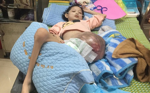 Cô bé Lưu Thị Hồng Phương bị ung thư xương bệnh tiến triển nặng