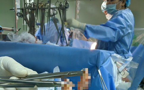 Khối u như đùi ếch bám vào tim suýt đoạt mạng cụ bà 80 tuổi