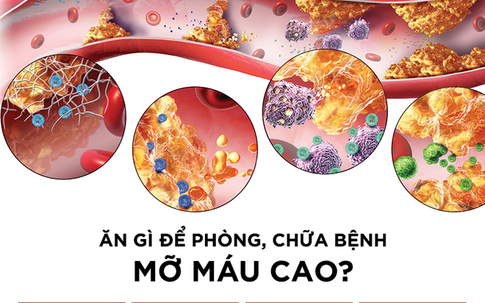 Chuyên gia dinh dưỡng: Ăn loại thực phẩm này không chỉ khỏe, mà còn không lo bệnh mỡ máu