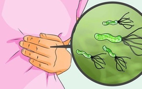 4 dấu hiệu cho thấy dạ dày chứa vi khuẩn HP dễ gây ung thư