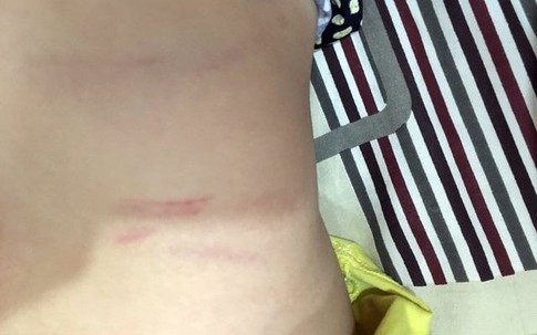 Vụ phụ huynh đòi bồi thường 100 triệu đồng: "Tôi không đưa sự việc này ra để làm tiền!"