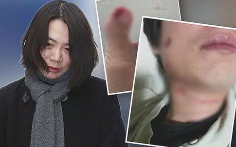Đời tư bê bối của ái nữ tập đoàn hàng không Hàn Quốc: Xem người như cỏ rác, đến chồng con cũng bị đánh đập không thương tiếc