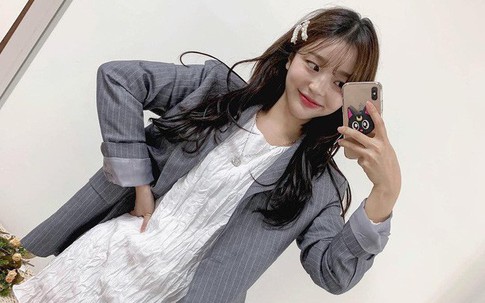 Biết là kẹp tóc đang hot, nhưng muốn xinh trẻ và không sến với phụ kiện này thì nhất định phải biết vài tips sau