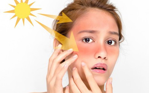 Dùng kem chống nắng cần tránh những việc này để da bạn không bị nám, sạm