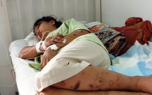 Thai phụ bị giam giữ, tra tấn đến sảy thai ở Sài Gòn: "Chỉ vì hơn 1 triệu đồng sao mà tàn ác với nhau thế"