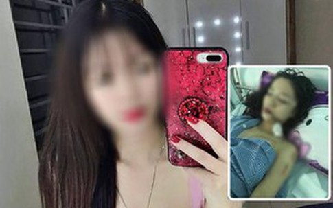 Cô gái xinh đẹp bị rạch mặt ở Bắc Ninh do mâu thuẫn chuyển phòng
