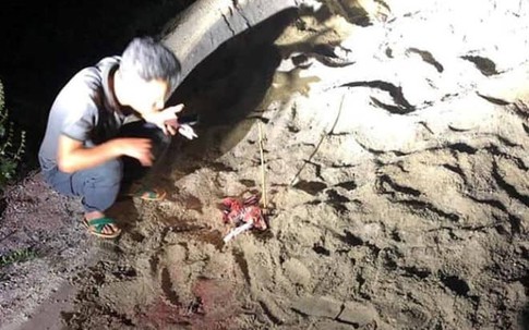 Gia đình bé trai 7 tuổi bị gần chục con chó dữ tấn công ở Hưng Yên đã xin con về nhà