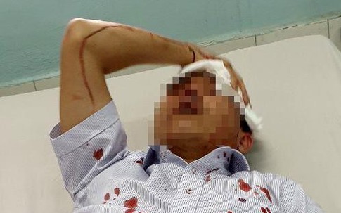 Đậu ôtô trước chung cư, 2 người bị nhóm côn đồ đánh nhập viện