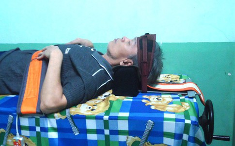 “Quá tam ba bận” mới điều trị dứt thoát vị đĩa đệm