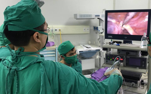 Vòng tránh thai “lạc chỗ” trong ổ bụng bệnh nhân nữ 63 tuổi