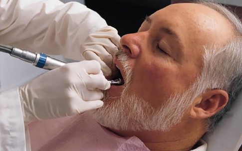 Các bệnh răng miệng thường gặp ở người cao tuổi