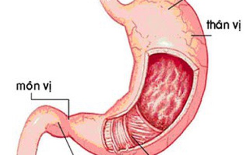 Viêm hang vị sung huyết có nguy hiểm?