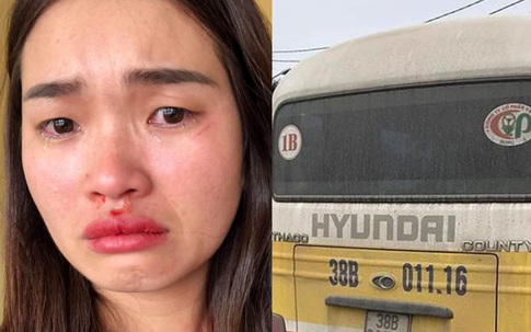 Điều tra vụ hành khách tố bị nhà xe đánh đập dã man giữa đường
