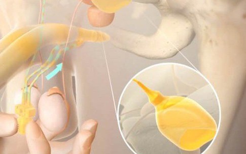 Dùng "công tắc" điều khiển "cậu nhỏ" theo ý muốn