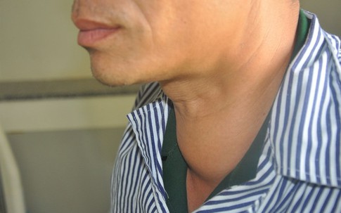 Nếu số phận bắt phải bị ung thư, nhiều người ước "được" mắc loại bệnh này