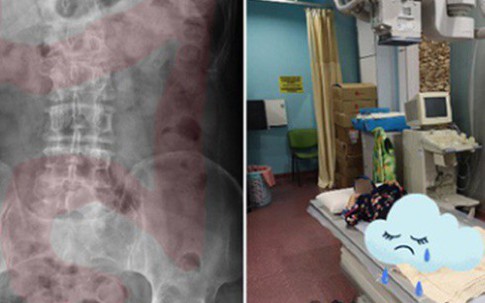 Bé gái 11 tuổi nhập viện cấp cứu vì đau dạ dày, bác sĩ chỉ đích danh thủ phạm là 1 sở thích tai hại của rất nhiều bé