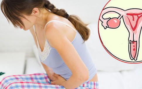 Ngày càng nhiều người trẻ mắc ung thư cổ tử cung vì lối sống không an toàn